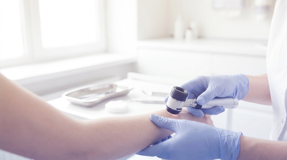 Consultație de dermatologie cu dermatoscopie la Clinica Medstoria, Râmnicu Vâlcea